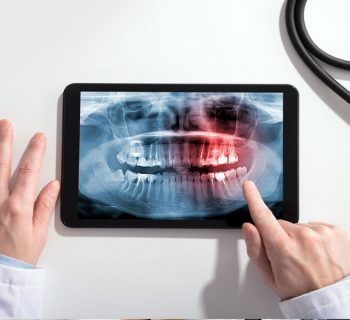 Is Digital X-ray Necessary?