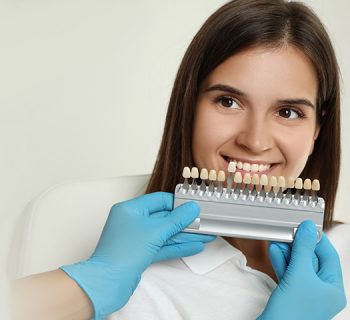 Everything You Should Know About Dental Veneers